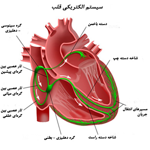 ارتیمی