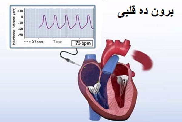 برون ده قلبی