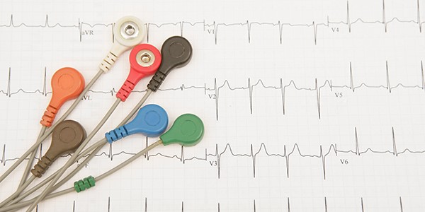 تست ECGنحوه انجام الکتروکاردیوگرام ،مدت زمان و تفسیر نوار ECG