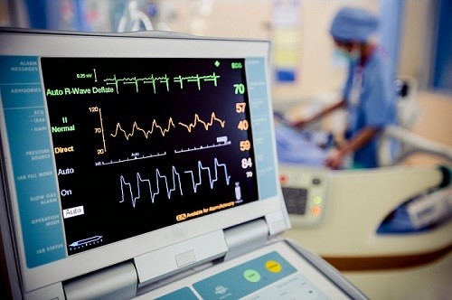 تستECG به چه منظور انجام می‌شود