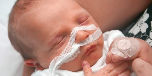 زجر تنفسی در نوزادان