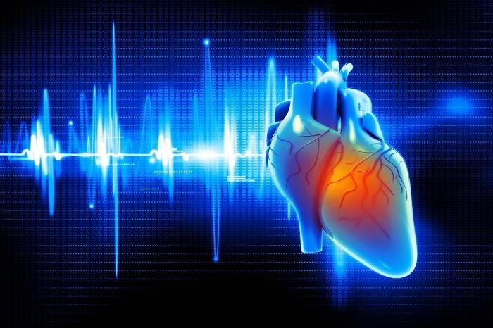 سندرمQT چیست؟