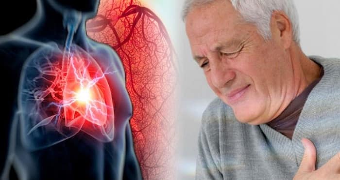 عفونت قلب (اندوکاردیت قلبی) چیست و چگونه درمان می‌شود؟