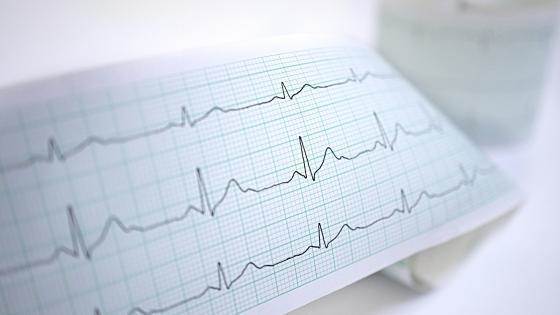 علائم سندرم QT طولانی چیست؟