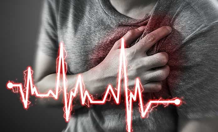 علائم سکته قلبی یا آنفارکتوس میوکارد