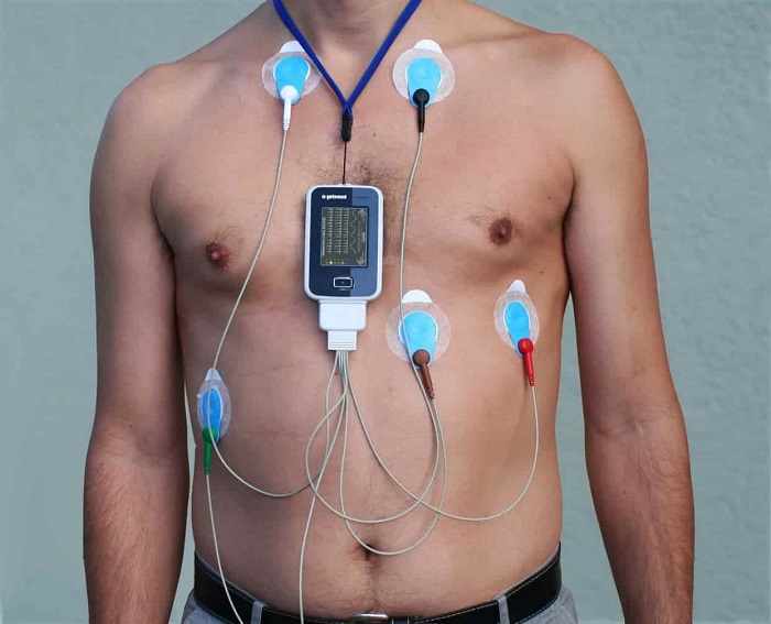 هولتر ریتم قلب عملکرد، مزایا و مراقبتهای هولتر 24ساعته ریتم قلب-min-compressed